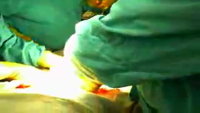 Child Birth Video