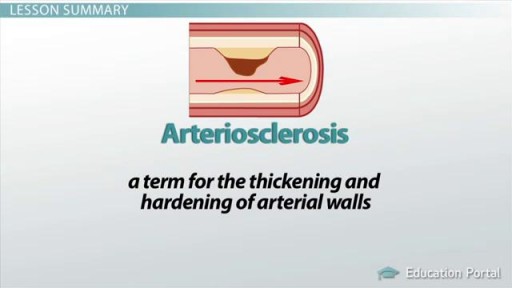 ⁣Difference between arteriosclerosis and atherosclerosis