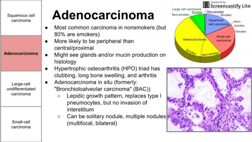 ⁣Cancers of the lung