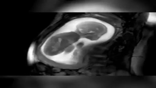 ⁣MRI scan of a 23-week-pregnancy