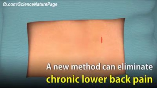 ⁣New method can eliminate lower back pain.