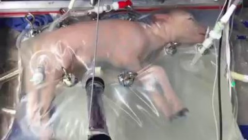 ⁣Artificial Womb!