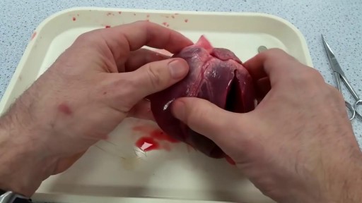 ⁣Heart dissection Explaination