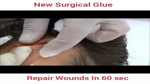 ⁣wound Repair in 60 seconds
