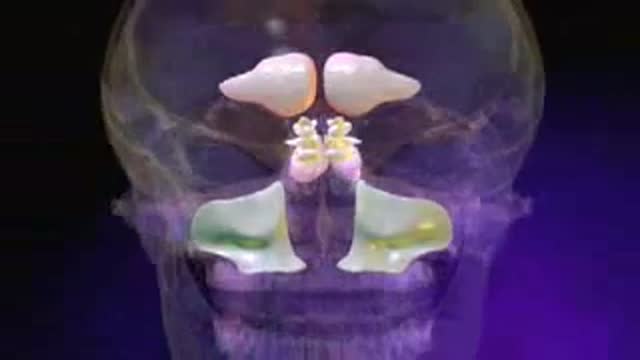 Sinusitis Animation