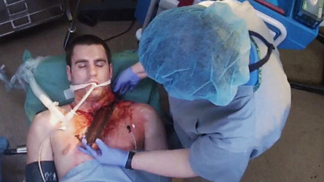⁣Chainsaw Blade Inside Neck Removal Surgery