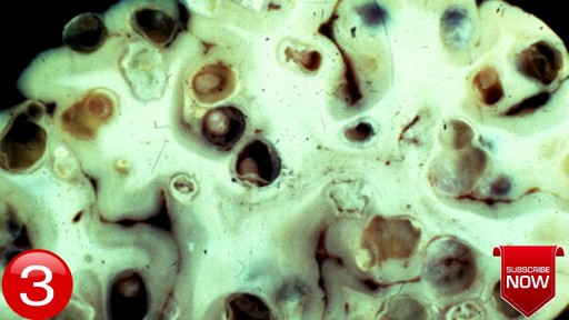 ⁣Terrible Horrifying Creatures Found Living Inside a Human Body