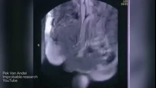 MRI Scans Human Body Internal Organs During Sex