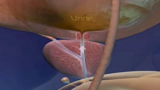 ⁣Sperm Formation and Pathway Ejaculation