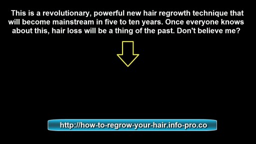 ⁣Home Remedies For Hair Fall And Regrowth, Hair Regrowth, Hair Regrowth Supplements