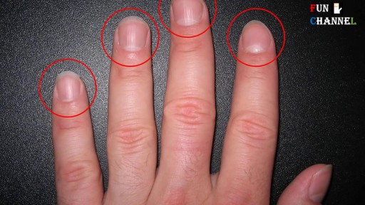 ⁣Half Moon Shape on Your Nail Causes
