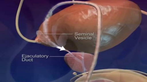 ⁣Medical Videos - Pathway and Ejaculation of Sperm