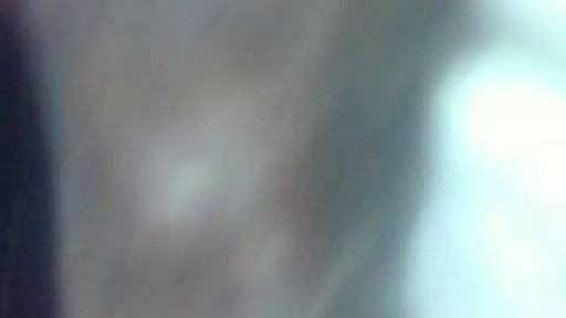skin sargury