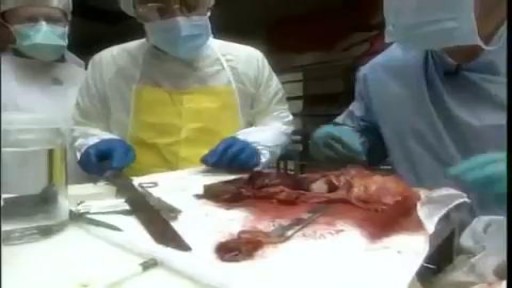 ⁣Poisoned Human Body Medical Dissect