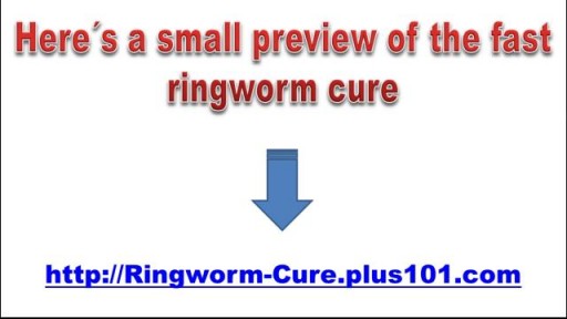 ⁣Ringworm On Chin, Best Way To Treat Ringworm, How Do I Get Rid Of Ringworm, How To Stop Ringworm