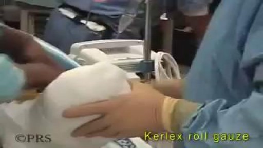 ⁣Above Knee Leg Amputation Surgical Procedure