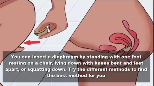 How To Insert a Female Diaphragm for Birth Control