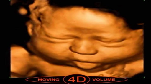 ⁣What is 4D Ultrasound Scan