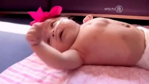 ⁣Baby Born with Heart Outside Chest