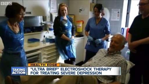 How does shock therapy for depression work?