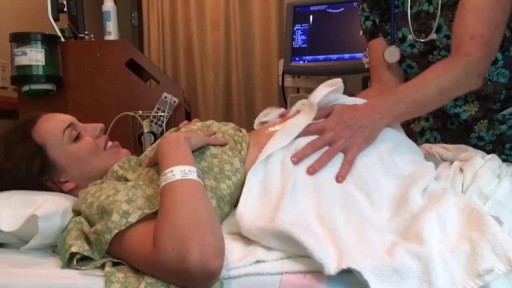 ⁣Successful External Cephalic Version (ECV) in 30 seconds