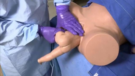 ⁣How to Deliver a Baby in Breech Presentation ?