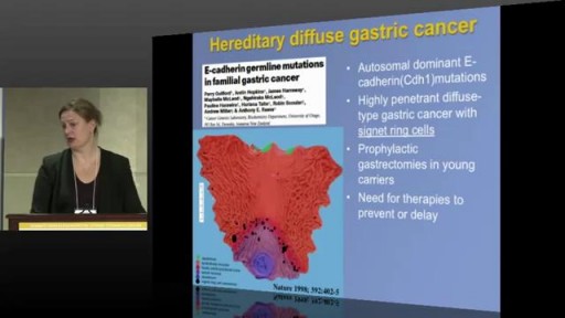 ⁣Gastric Cancer Etiology, Genetics, Diagnosis and Staging