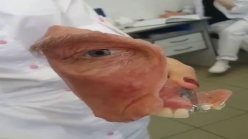 ⁣Amazing face surgery