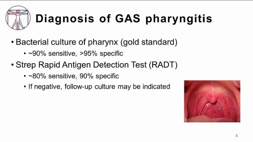 ⁣GAS pharyngitis: Diagnosis and Treatment