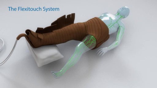 ⁣The Flexitouch System Lymphedema Pump