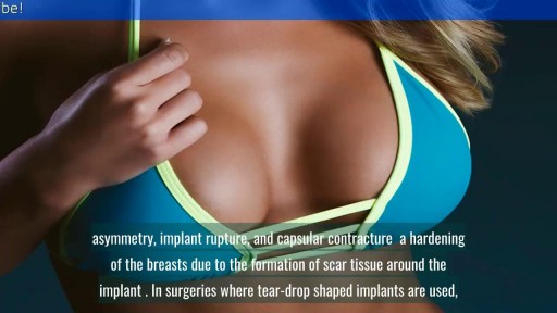 ⁣Breast Augmentation: From Cost to Complications