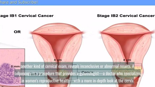 ⁣Cervical Biopsy Overview