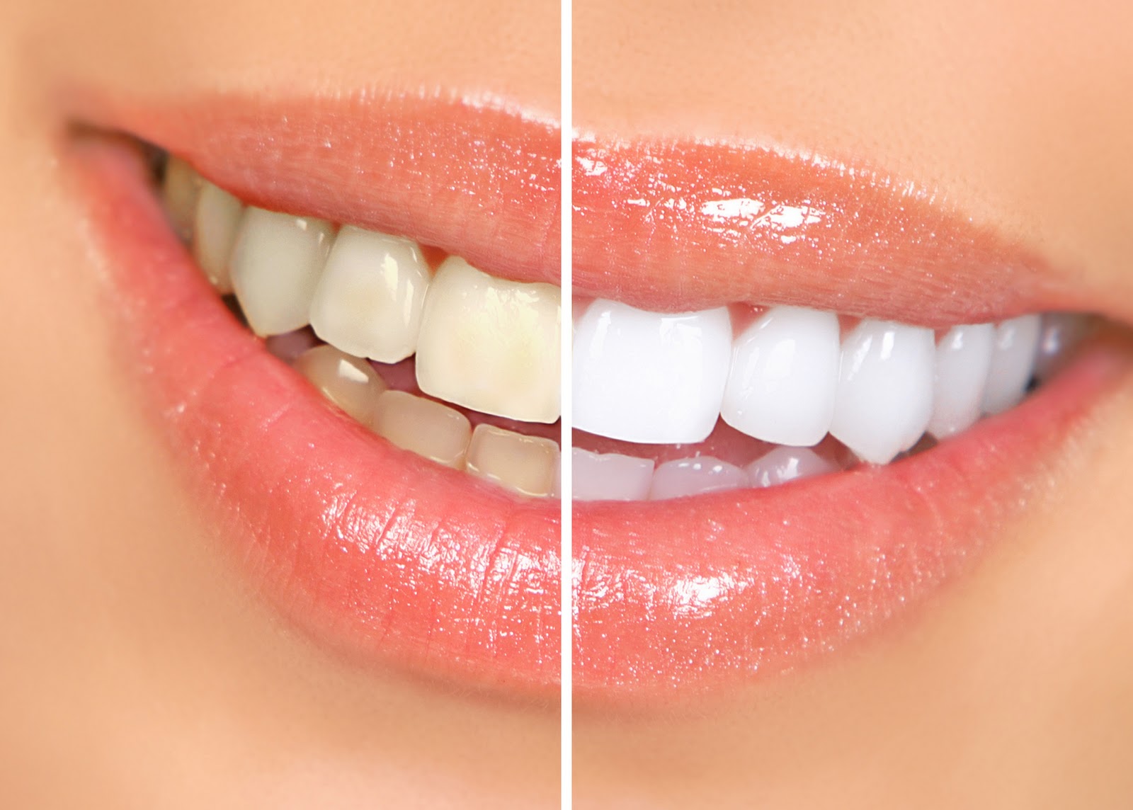 ⁣Natural Ways to Whiten Teeth at Home