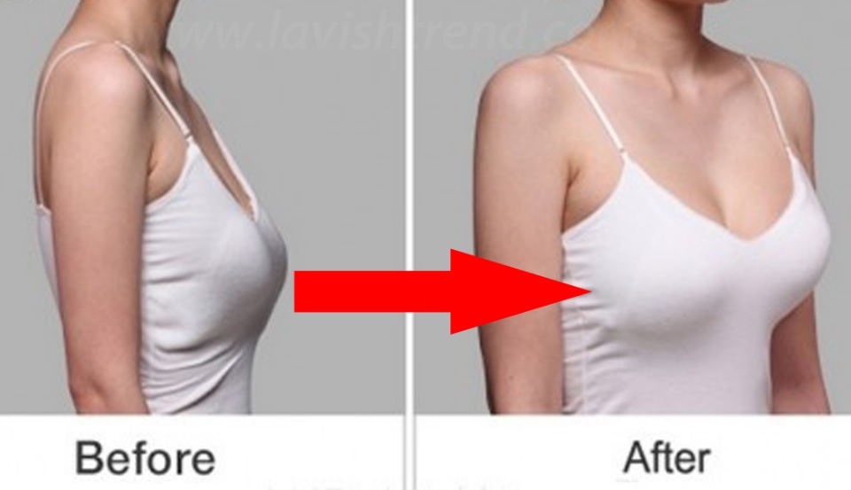 How to Get Rid of Saggy Breasts Naturally