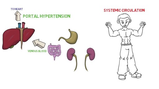 Portal Hypertension Pathophysiology