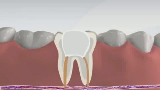 ⁣What is Root Canal??