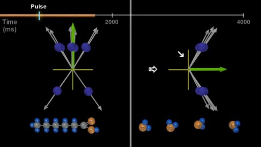 MRI: Basic Physics & a Brief History