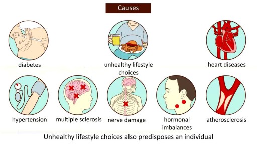 Erectile Dysfunction : Causes, symptoms and treatment