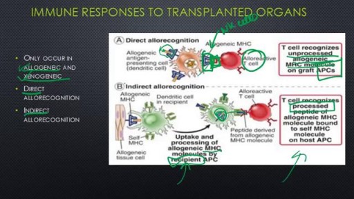 Transplant Immunology