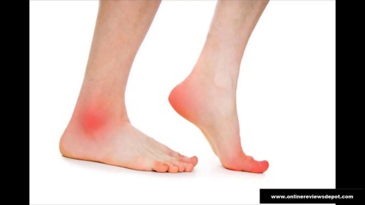 how to treat peripheral neuropathy?