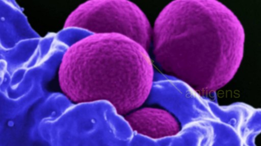 Immune Responses During a Lupus Flare