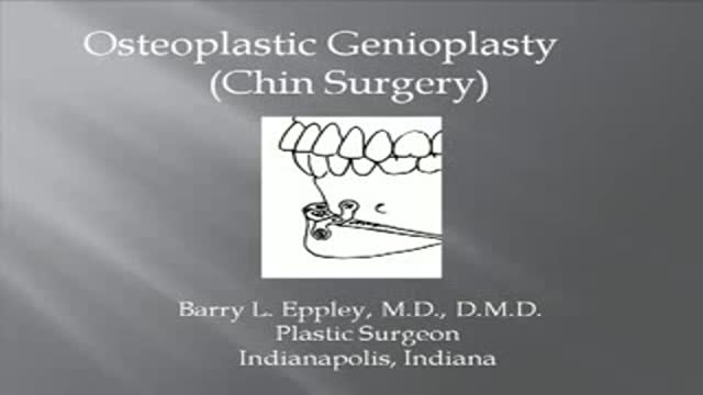 Plastic Surgery of the Chin