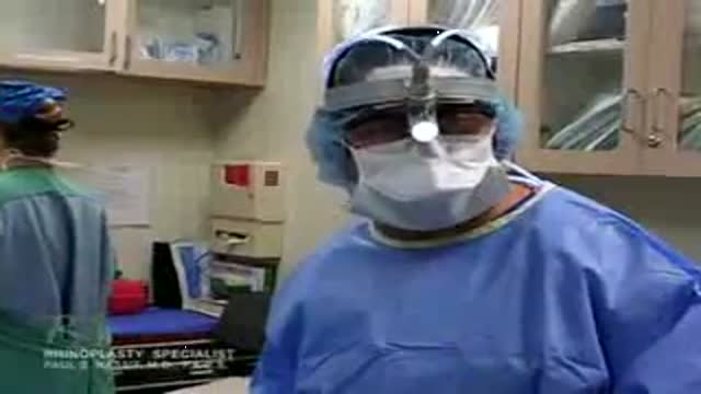 Closed Rhinioplasty Exposing The Nasal Structures