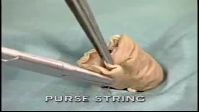 ⁣Purse String Suture