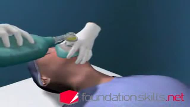 ⁣EndotracheaI Intubation During General Anaesthesia