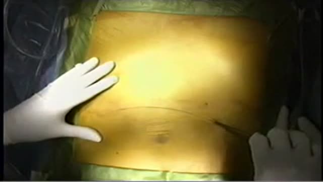 ⁣Living Donor Liver Transplantation