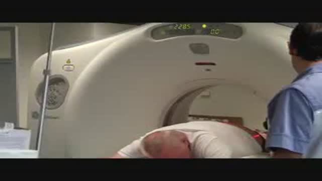 Spirotome Bone biopsy for osteolytic lesions under CT guidance