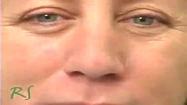 Real Housewives of Beverly Hills Rhinoplasty Specialist Dr. Paul Nassif