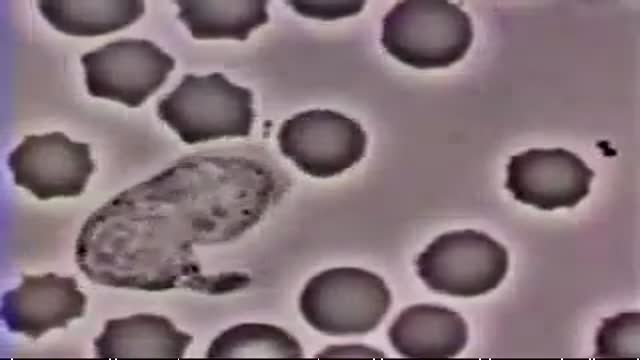 ⁣White Blood Cell Chasing Bacteria