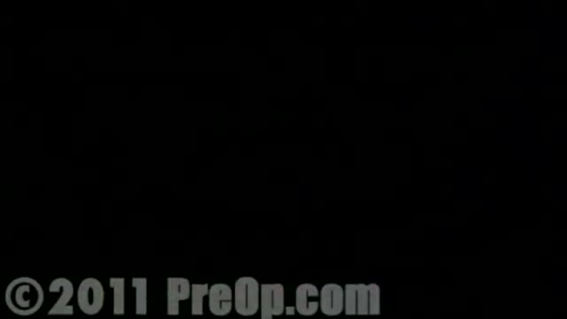 ⁣Coronary Artery Bypass Surgery CABG Heart HD